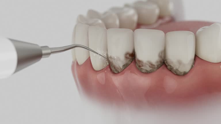 Reliable Dental Implants contractor in Centerville, PA by Smile Center Dentistry